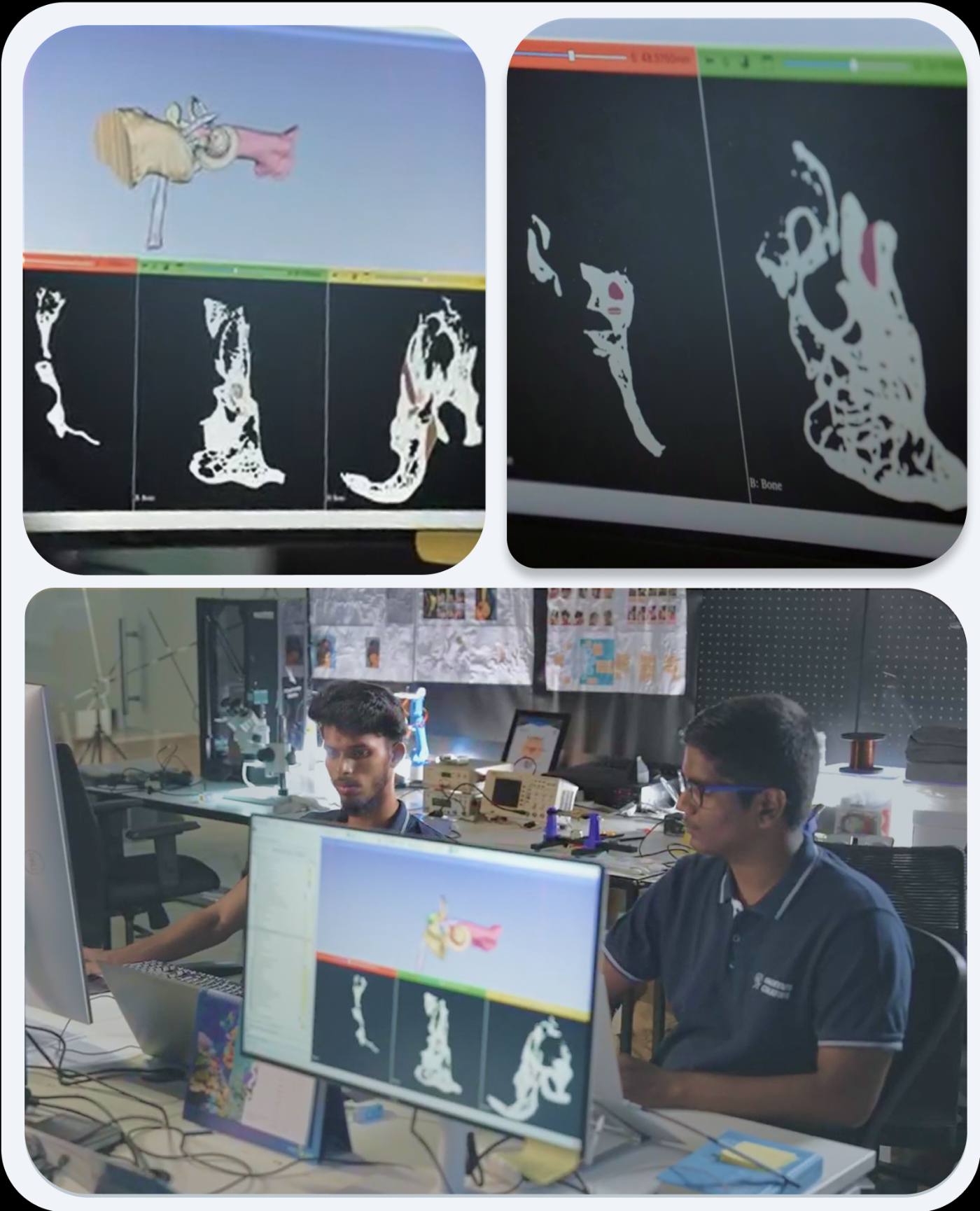 Computational physics on cochlear scans